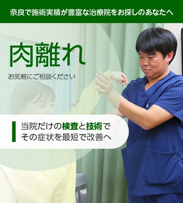肉離れもご相談ください